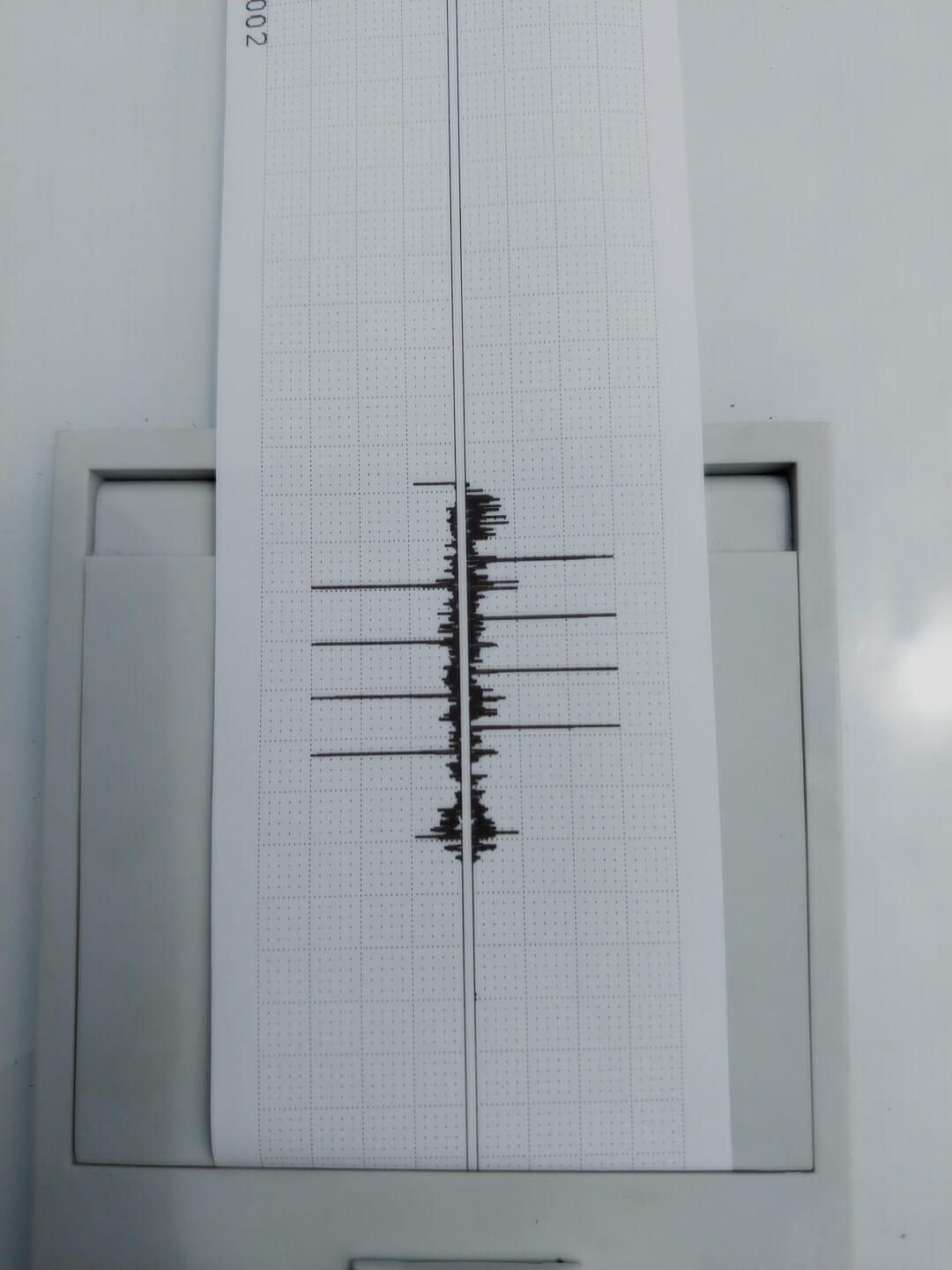 Ultrasonic end-area testing of drill collars and heavy-weight drill pipe